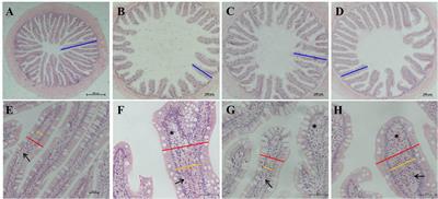 Tryptophan metabolism and gut flora profile in different soybean protein induced enteritis of pearl gentian groupers